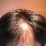 ポリピュアを購入するためには？